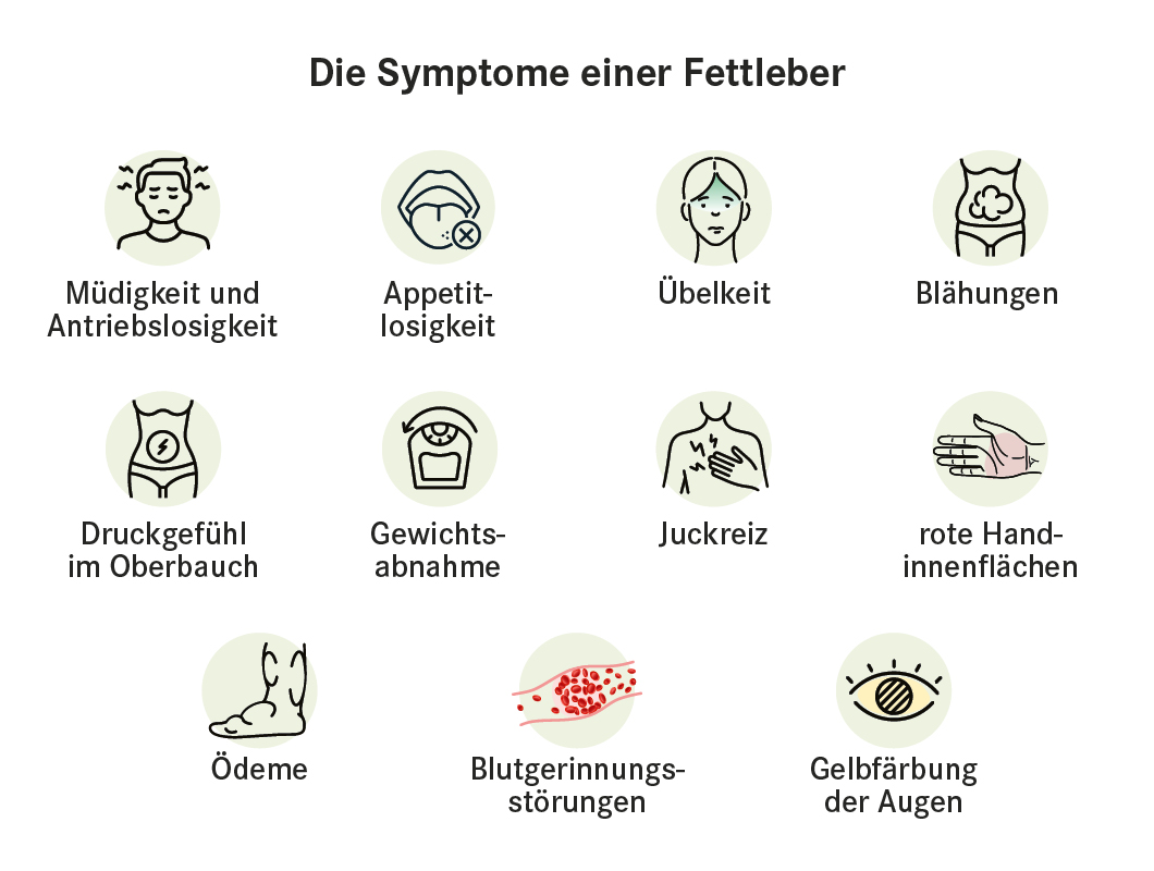 Fettleber Symptome: Müdigkeit, Appetitlosigkeit, Übelkeit, etc.